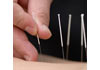 Thumbnail picture for Christchurch Acupuncture Centre