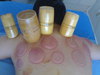 Click for more details about Auckland Acupuncture acupressure A tender Life Care The   Holistic Therapy Clinic
