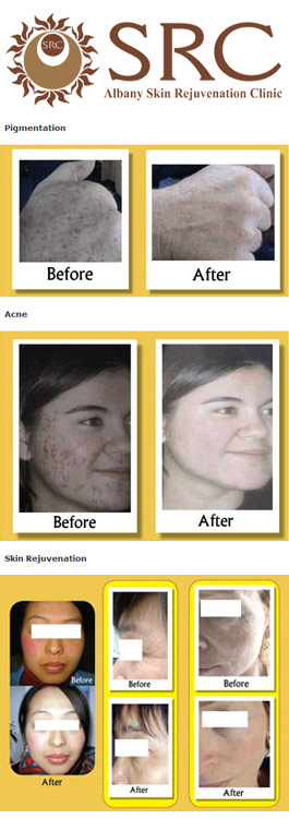 Profile picture for Albany skin rejuvenation clinic